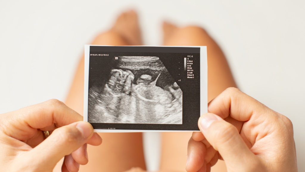 Maternal Exposure To Air Pollution May Raise The Risk For Heart Defects In An Unborn Child 4 Maternal Exposure To Air Pollution May Raise The Risk For Heart Defects In An Unborn Child